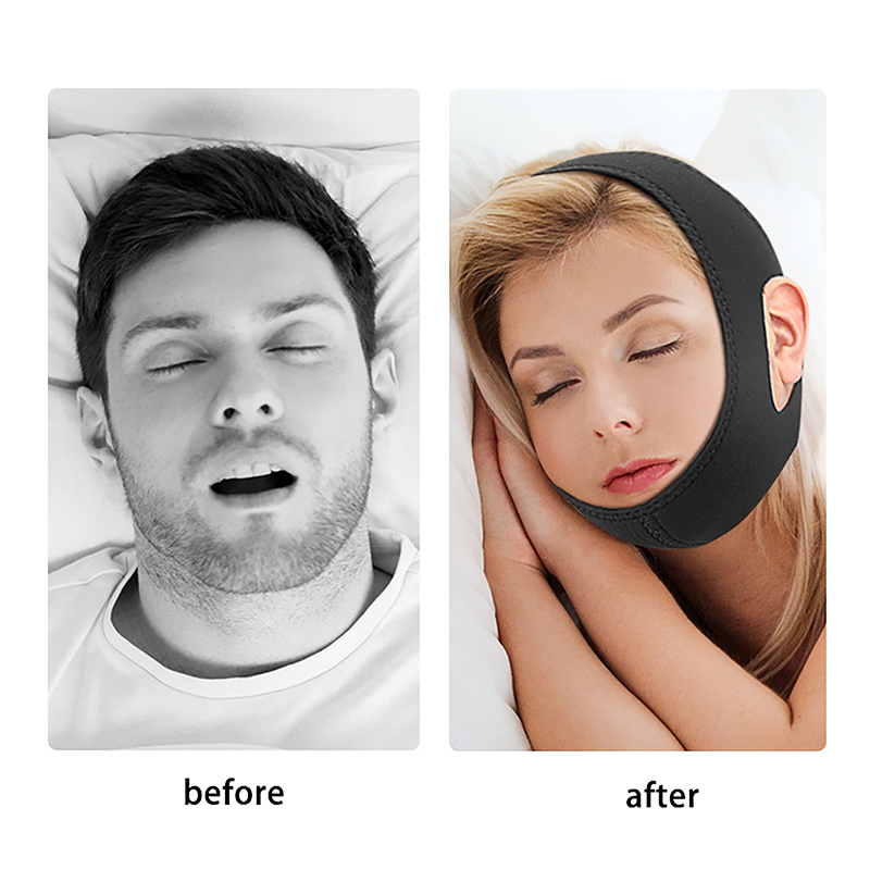 Anti Snore Chin Strap Adjustable - 調整可能な新型ネオプレン製いびき防止ストラップ、いびき防止チンストラップ、いびき防止マウスガード、いびき対策、睡眠時のいびき軽減